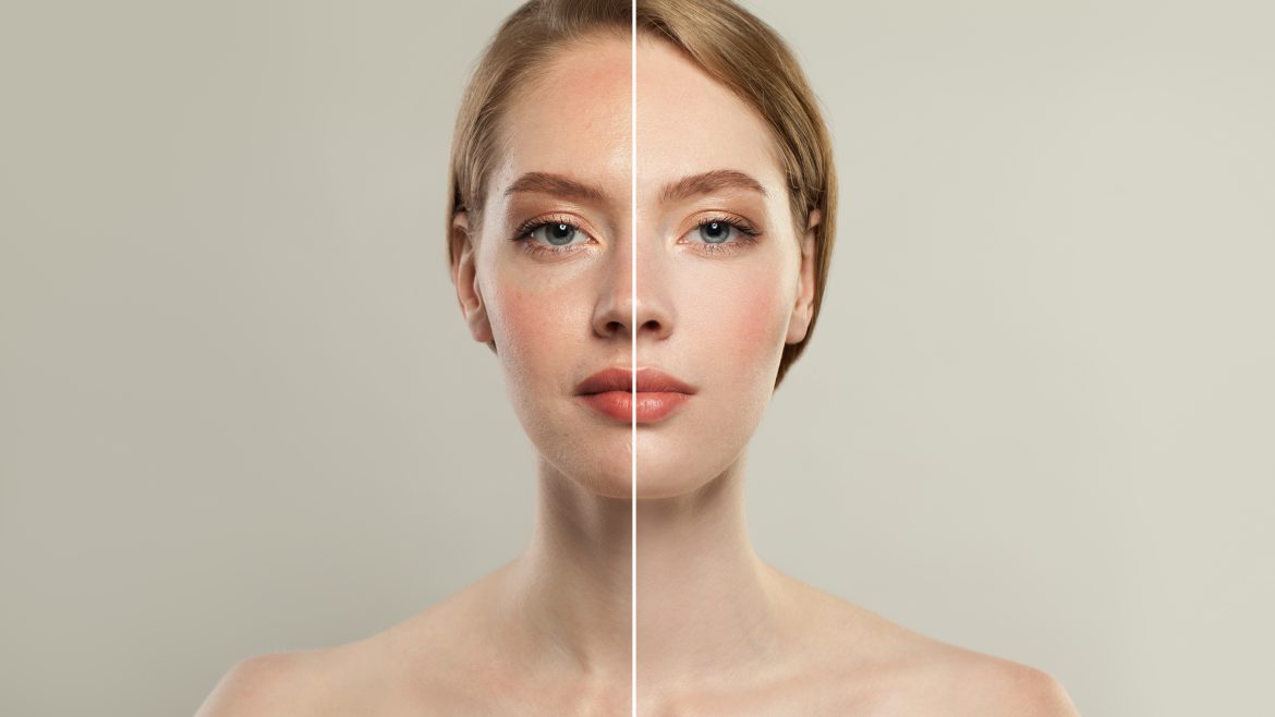 Hydrafacial Kompleks İşlemi Nedir? Detayları