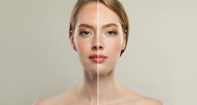 Hydrafacial Kompleks İşlemi Nedir? Detayları